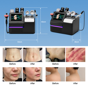 448K CAP-RES& EMS CARE Diseño de particiones transparentes Modo dual Proporciona un calor suave Apoya la microcirculación superficial para el rostro y masajes - Product Image 3