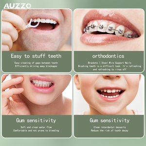 Mini hilo dental de agua de viaje portátil, limpiador de dientes inalámbrico inteligente, irrigador Oral recargable, cuidado Dental impermeable con punta de chorro - Product Image 4