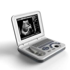 VS-V573 Draagbare Vasculaire Echografie Scanner <span class=keywords><strong>Ce</strong></span> Goedgekeurde Draagbare Echografie Medische Laptop Usg <span class=keywords><strong>Machine</strong></span> - Product Image 2