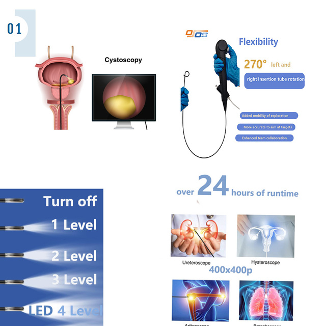 Phone Contact Disposable Flexible Ureteroscope Computer Contact Usb Digital Flexible Ureteroscope Single Use Ureteroscope