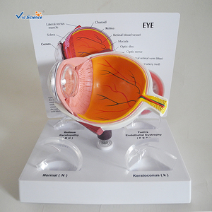 Modelo Médico <span class=keywords><strong>de</strong></span> ojos patológicos <span class=keywords><strong>de</strong></span> Cornea - Product Image 2