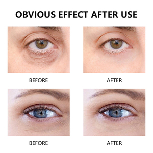 OEM ODM Sérum pour <span class=keywords><strong>les</strong></span> <span class=keywords><strong>yeux</strong></span> <span class=keywords><strong>Revive</strong></span> Rétinol Niacinamide Correction hydratante anti-rides pour <span class=keywords><strong>les</strong></span> poches gonflées Ridules cernes - Product Image 5