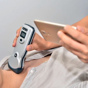 Draadloze Kleur <span class=keywords><strong>Doppler</strong></span> Echografie Sonde Handheld Echografie Sonde 80 Array Elementen 32 Kanalen - Product Image 5