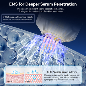 Dr.pen Q1S Microneedling Pen EMS Microcurrent LED Light Therapy Beauty Device for Stretch Mark Removal Acne Treatment Skin Care - Product Image 3