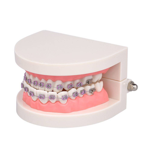 Modelo Dental Portátil de PVC para Enseñanza de Ortodoncia con Aparatos Ortodóncicos - Product Image 2