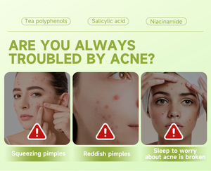 36 Cerotti Idrocolloidali per Acne, Cosmetici Originali per Coprire Acne e Imperfezioni su Viso e Pelle - Product Image 2