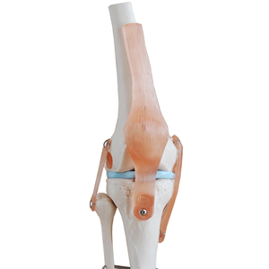 ข้อต่อเข่า Life - Product Image 1