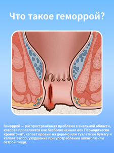 <span class=keywords><strong>Crema</strong></span> Anti-Hemorroides al por Mayor OEM ODM, Elimina Eficazmente el Dolor por Sangrado Anal, Hinchazón, Fisuras Anales, Ungüento para Hemorroides - Product Image 6