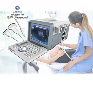 LANNX uRason P9 Neue Produkte Tragbarer Eco graph Digital Laptop Schwarz-Weiß-Schwangerschaft Ultraschall-Fetal-Ultraschall gerät