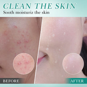 Limpiador facial OEM <span class=keywords><strong>BIOAQUA</strong></span> con logotipo personalizado, ácido hialurónico y Niacinamida, Limpieza Profunda, control de aceite, lavado de cara brillante para uso diario - Product Image 4