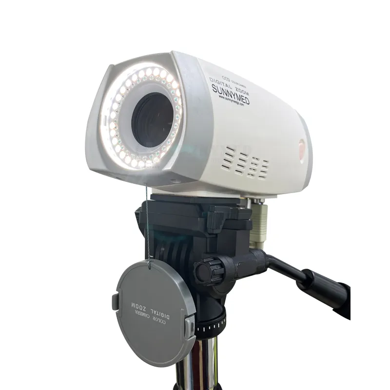 Jinekoloji için SY-F005HD-1 Mini Hd kolposkop kamera ekipmanları taşınabilir dijital güzel vajina Video kolposkop
