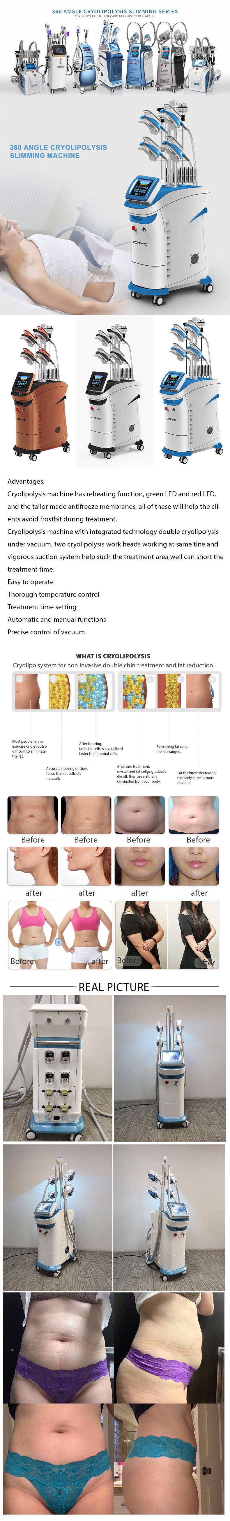2021 sale Cold Body Cryotherapy Slimming Criolipolyse 4 Hands Cool Tech Sculpting Shape Fat loose Criolipolysis cyro