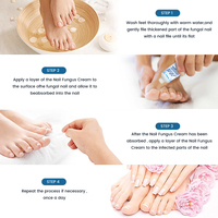 Crème anti-fongique pour les ongles Sumifun, traitement antifongique, pommade 20G