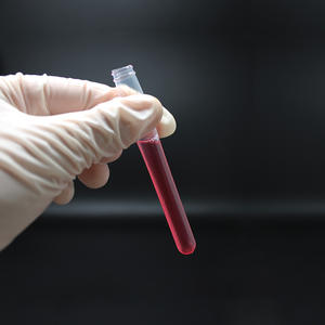 หลอดทดลองพลาสติกแบบใช้แล้วทิ้ง หลอดเก็บตัวอย่างแบบใส วัสดุ PE - Product Image 5