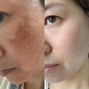 Crème Visage Correctrice Anti-Taches Pigmentaires et Mélasma pour Éclaircissement de la Peau (kg) - Product Image 4