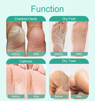 Masque exfoliant pour les pieds avec de la niacinamide et de la vitamine C pour éliminer les peaux mortes sur les semelles, lissage et blanchiment, format en patch, OEM/ODM