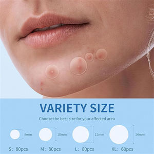 แผ่นแปะสิวรูปทรง<span class=keywords><strong>แมว</strong></span><span class=keywords><strong>น่า</strong></span><span class=keywords><strong>รัก</strong></span> สูตรเฉพาะสำหรับขายส่ง ผลิตจากวัตถุดิบวีแกน ผสมกรดซาลิไซลิก ลดบวม ดูแลผิวหน้า รับผลิตแบรนด์ส่วนตัว - Product Image 3