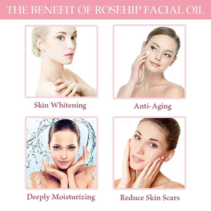 エッセンシャルオイルの香り エッセンシャルアロマセラピーオイル 卸売バルク価格 オーガニックローズヒップオイル 100% - Product Image 5