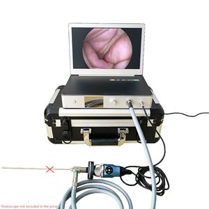 Draagbare Alles In Één Hd Fhd 1080P Chirurgische Medische Endoscoop Camera Voor Ent/Laparoscopie/Hysteroscopie/Urologie Chirurgie - Product Image 3