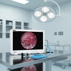 Cámara de Endoscopia Médica Camjoy Full HD con Función de Grabación para Clínicas y Diagnóstico Móvil - Product Image 2