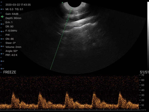 Sonda lineal Rectal inalámbrica para vaca/caballo, escáner de ultrasonido veterinario de embrión pequeño, a buen precio, a prueba de agua, a prueba de agua, de 2 pulgadas - Product Image 3