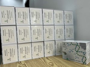 Kit humain de IL-2 ELISA, Interleukin-2, sensibilité élevée, 96 essais, pour la recherche d'immunothérapie - Product Image 4