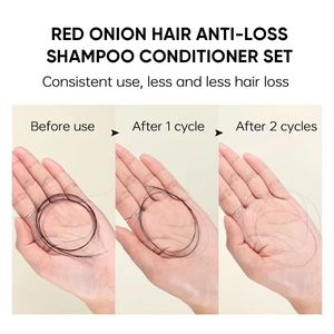 2025 nuovo arrivo senza solfato di Anit-Hair Loss rafforza la ricrescita della cipolla rossa <span class=keywords><strong>Shampoo</strong></span> per la crescita dei <span class=keywords><strong>capelli</strong></span> e Set di balsamo - Product Image 3