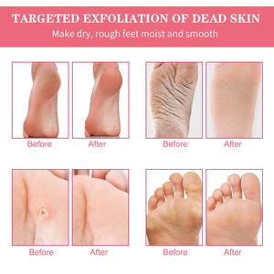 <span class=keywords><strong>ALIVER</strong></span> Maschera Esfoliante Piedi 3 in 1 al Pesca, Scrub Peeling Delicato, Rimuove le Cellule Morte, Ripara i Talloni Ruvidi, Cura e Bellezza - Product Image 6