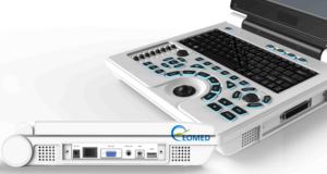 Harga pabrik Notebook sonografi pemindai Ultrasound Laptop hitam dan putih mesin Ultrasound dokter hewan BW30B - Product Image 6