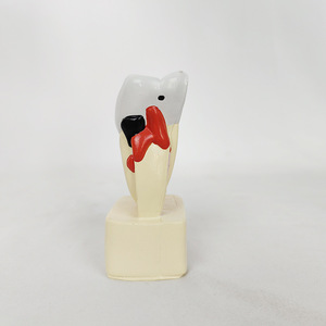 Khoa học y tế loạt nha khoa thực tế con người sâu răng nhỏ mô hình răng giả giải phẫu mô phỏng thực hành - Product Image 5