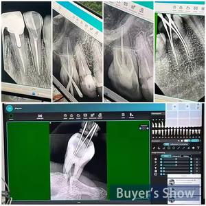 Vet Zensor Sensor Intraoral Digital, Sensor sinar X gigi dan RVG untuk peralatan dokter hewan - Product Image 6