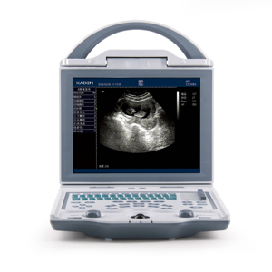 Appareil d'échographie noir et blanc, équipement d'imagerie médicale diagnostique, échographie portable 2D, appareil d'échographie portable pour ordinateur portable - Product Image 1