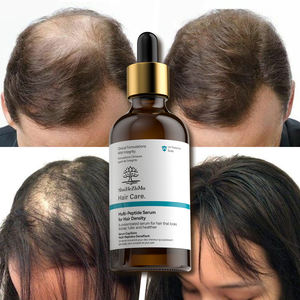Venta al por mayor aceite de crecimiento del cabello jengibre Vegano para el crecimiento del cabello suero <span class=keywords><strong>curar</strong></span> el <span class=keywords><strong>cuero</strong></span> <span class=keywords><strong>cabelludo</strong></span> y reparar el crecimiento del cabello suero - Product Image 2
