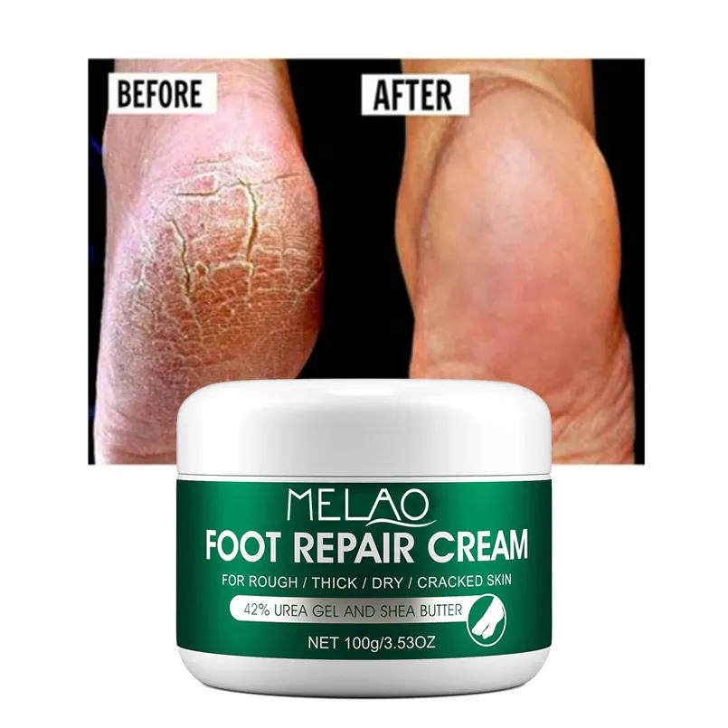 Scrub per piedi antimicotico per la riparazione dei piedi esfoliazione rimozione della pelle morta Peeling crema idratante per la cura dei piedi per talloni screpolati