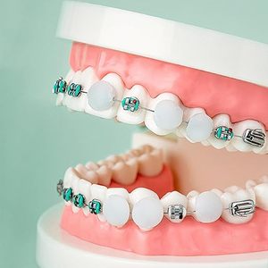 Appareil orthodontique de soins dentaires Cire anti-broyage de qualité alimentaire Protection orale Individuellement multi-usages Accessoire de blanchiment des dents - Product Image 3