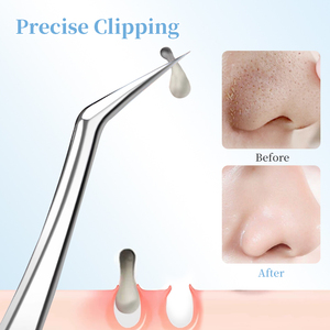 Pince à épiler extractrice de points noirs et de boutons en acier inoxydable de haute qualité, ultra-fine, pour le visage - Product Image 5