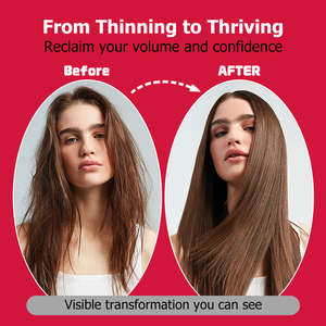 Gummies pour la croissance des cheveux très vendues avec vitamine biotine et calcium : nourrissent les cheveux clairsemés, réduisent la chute et augmentent l'épaisseur des cheveux - Product Image 5