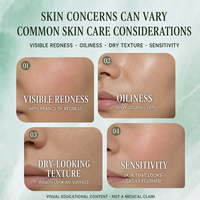 Crème personnalisable pour le soin des imperfections, pour peaux grasses et sujettes à l'acné, avec acide azélaïque, acide salicylique, niacinamide, gel apaisant et régulateur de sébum