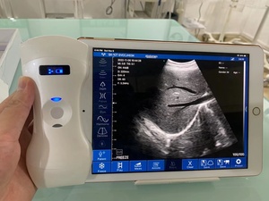 Ecógrafo Inalámbrico WiFi 3 en 1 MT Medical con Doppler Color, 192 Ultrasónica para Teléfono Android, iPad, Sonda Inalámbrica - Product Image 4