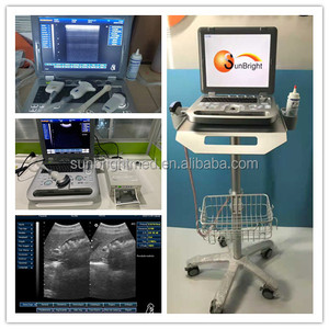 Equipo Médico de uso hospitalario, máquina de ultrasonido veterinario portátil, SUN-800D - Product Image 6