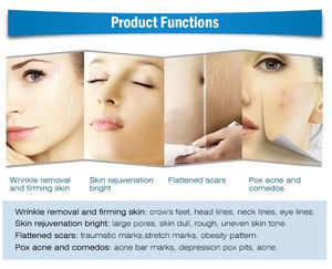 Appareil de microneedling fractionné par radiofréquence sous vide pour cliniques esthétiques et de soins de la peau professionnelles - Product Image 3