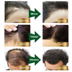 Sérums pour la repousse des cheveux à base de DHT, marque privée, traitement naturel contre la perte de cheveux, soin du cuir chevelu, biotine, sérum pour la croissance rapide des cheveux - Product Image 3
