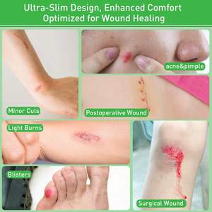Parches Hidrocoloides Flexibles Adhesivos, Seguros para la Piel y Resistentes al Agua, para Uso Diario - Product Image 6