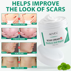 Crème personnalisée anti-acné et vergetures pour le visage et le corps, réparatrice des taches de rousseur et des cicatrices (chirurgie, blessures, brûlures, anciennes cicatrices) - Product Image 3