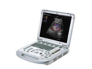 Échographe vétérinaire portable Mindray M7, meilleur échographe Doppler couleur en ligne pour petits animaux - Product Image 6