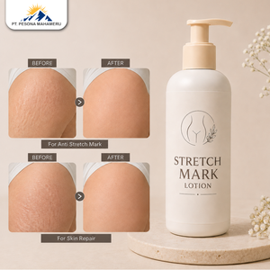 Bálsamo Corporal Nutritivo y Elástico con Botánicos para las Estrías - Product Image 1