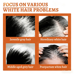 Siero Trattamento Antigrigio per <span class=keywords><strong>Capelli</strong></span> da Bianchi a Neri, Quantità Minima d'Ordine, per la Crescita dei <span class=keywords><strong>Capelli</strong></span> Maschili - Product Image 4