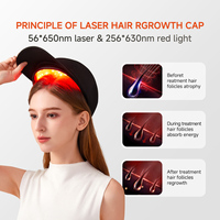 Casque laser à diodes Factory 312 pour la repousse des cheveux, traitement de la perte de cheveux, thérapie par lumière rouge