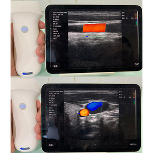 Appareil Suresult 4D et scanner à ultrasons sans fil <span class=keywords><strong>de</strong></span> <span class=keywords><strong>poche</strong></span> B <span class=keywords><strong>Doppler</strong></span> couleur - Product Image 2
