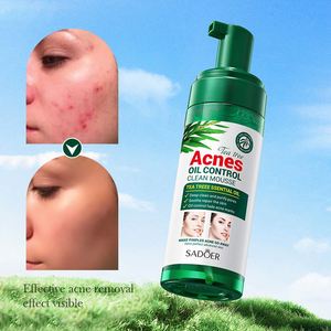 BIOAQUA Mousse nettoyante anti-acné bio pores humidité soins de la peau <span class=keywords><strong>arbre</strong></span> à thé aloe vera lavage du visage brosse nettoyante moussante pour le visage - Product Image 4